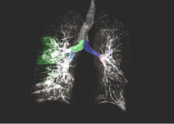 醫療人工智慧聯合學習