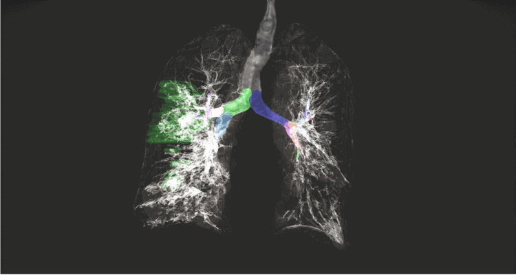 醫療人工智慧聯合學習